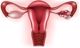  Cập nhật 3 phương pháp điều trị lạc nội mạc tử cung 